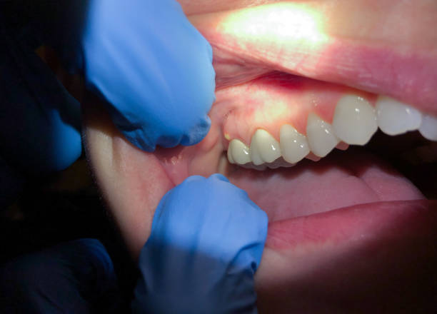 Best Emergency Dental Care for Sports Injuries in Prairie Grove, AR