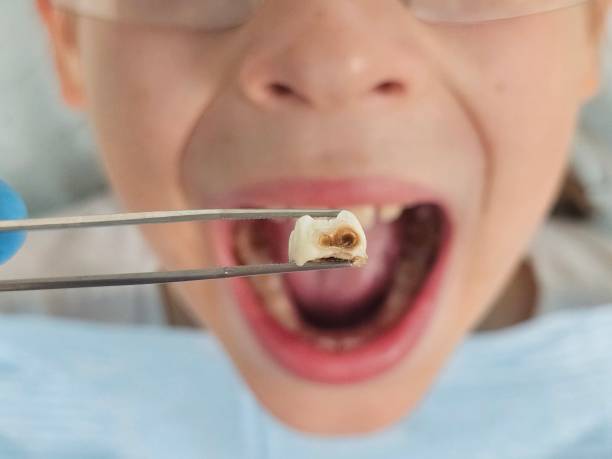 Professional Emergency Dental Service in AR
